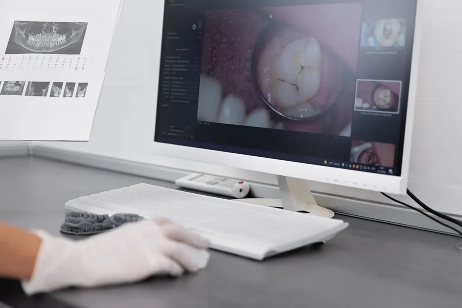 Digitalna-stomatologija-2026-Kako-CAD-CAM-menja-standarde-u-protetici-1200×721-111